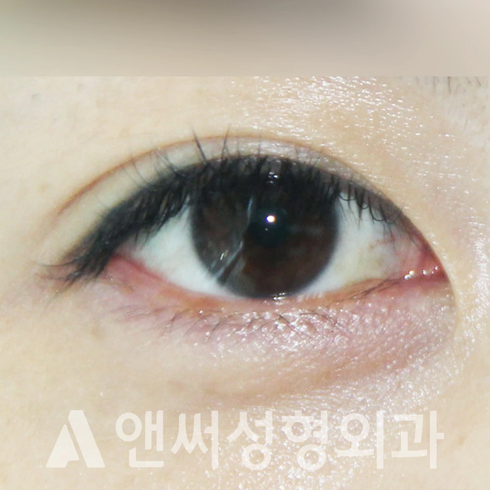 Answer Plastic Surgery case 408: After