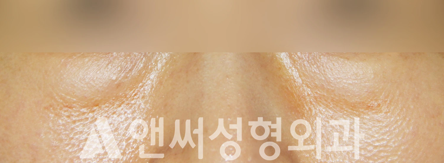 Answer Plastic Surgery case 407: Before