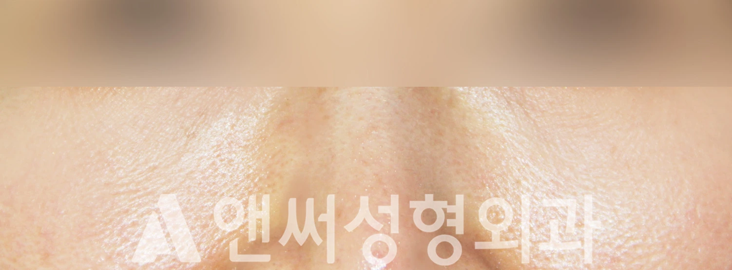Answer Plastic Surgery case 407: After