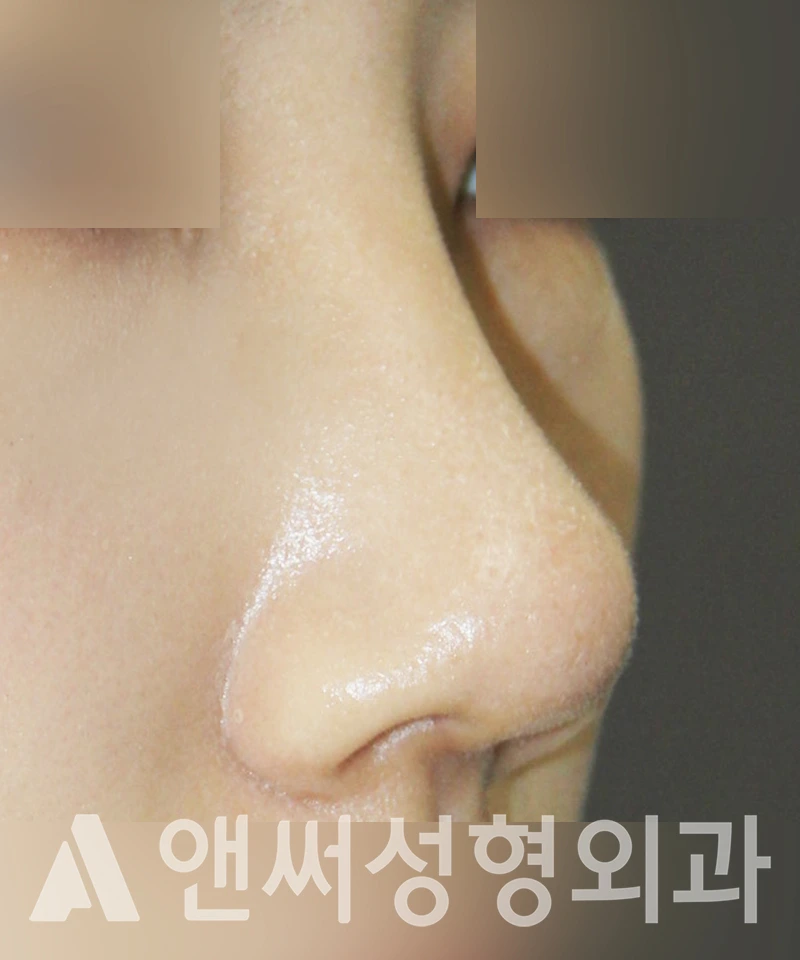 Answer Plastic Surgery case 406: After