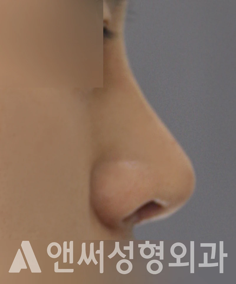 Answer Plastic Surgery case 405: After