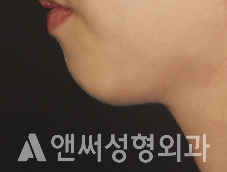 Answer Plastic Surgery case 404: Before