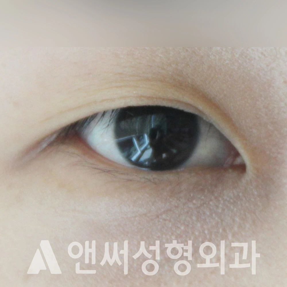 Answer Plastic Surgery case 403: Before