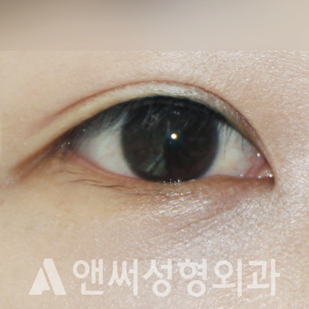 Answer Plastic Surgery case 403: After