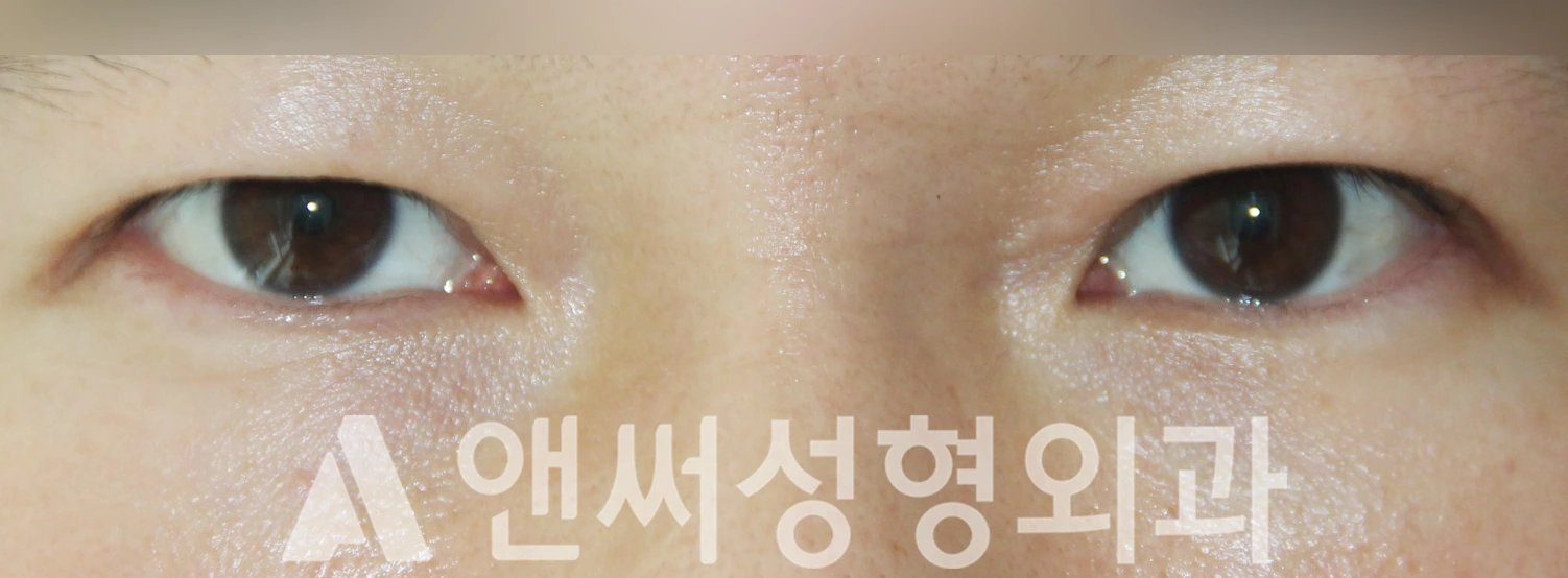 Answer Plastic Surgery case 402: Before