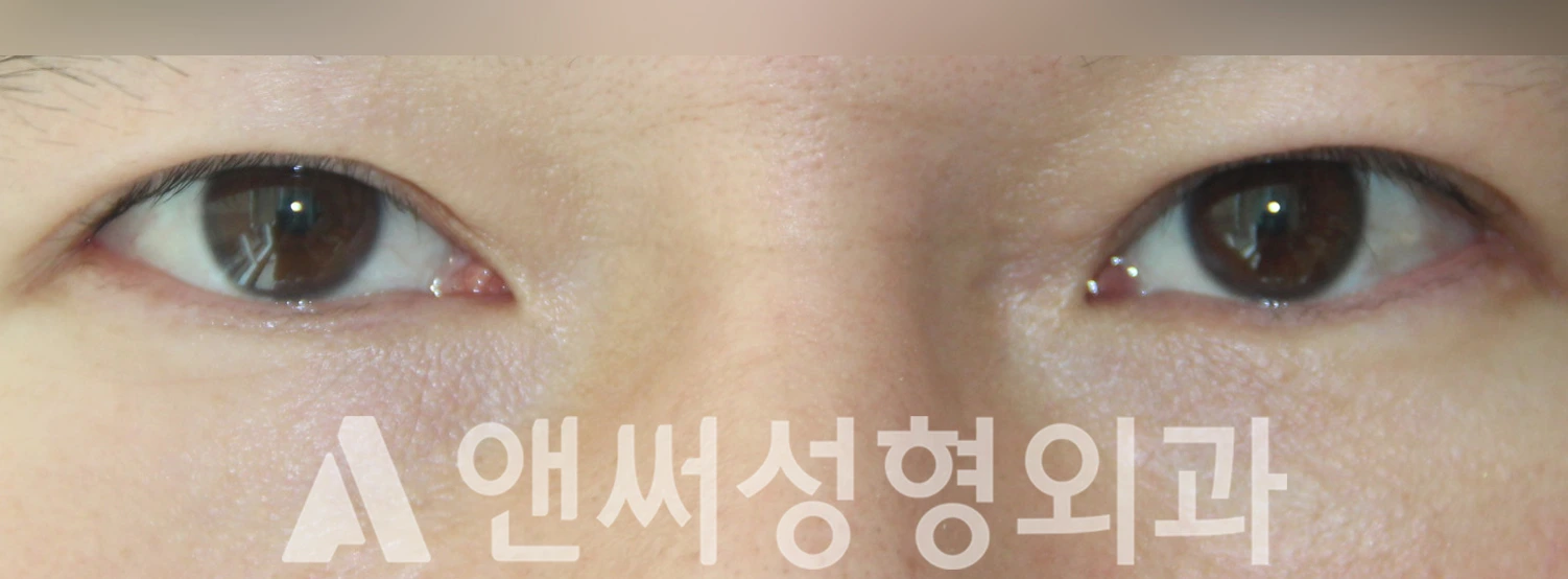 Answer Plastic Surgery case 402: After