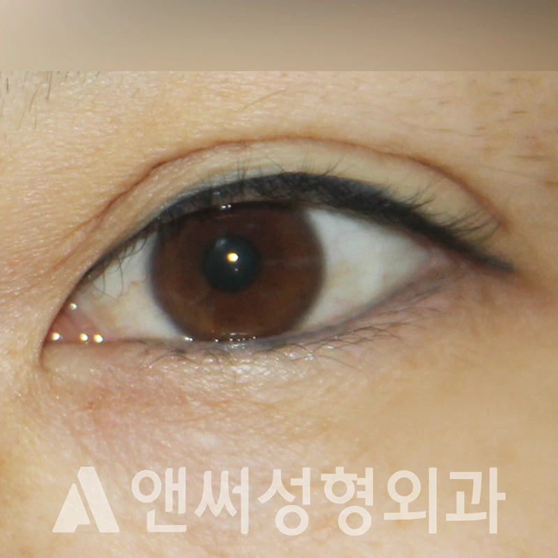 Answer Plastic Surgery case 401: Before