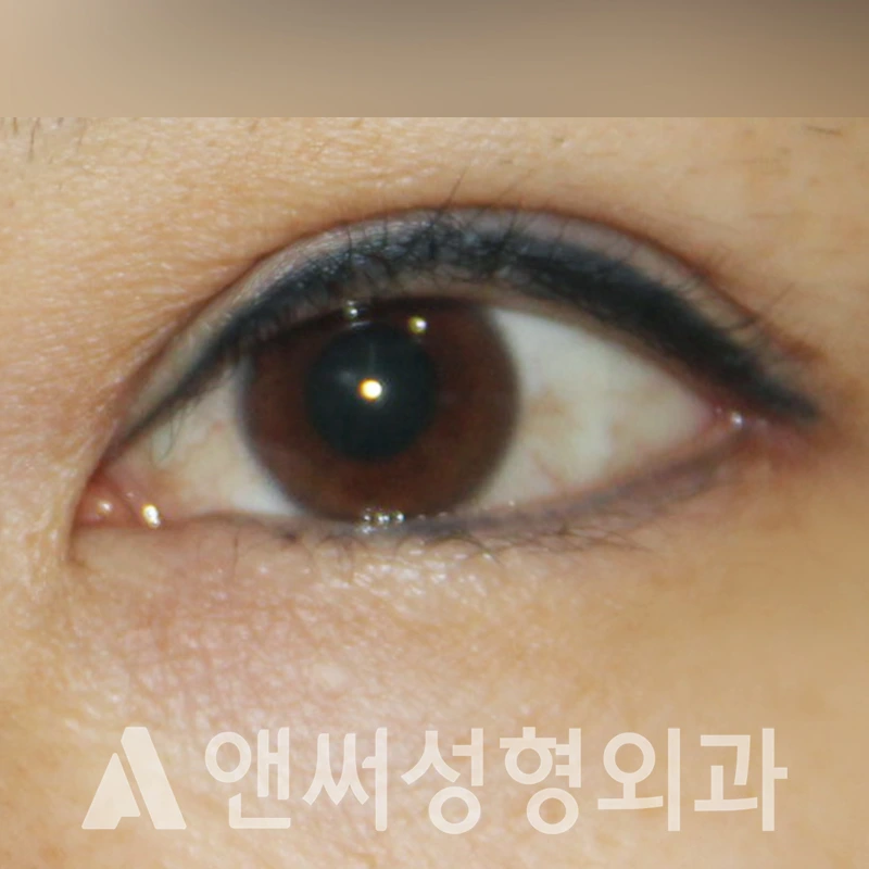 Answer Plastic Surgery case 401: After