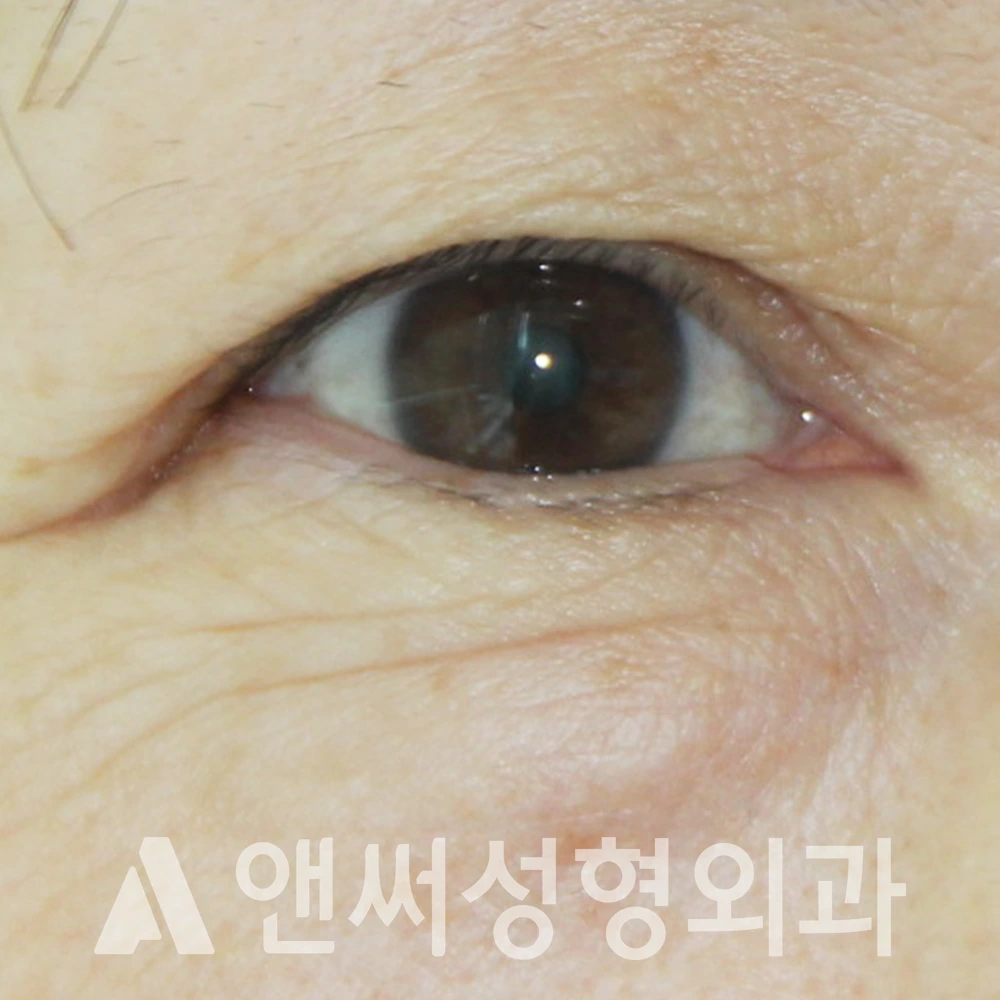 Answer Plastic Surgery case 399: Before
