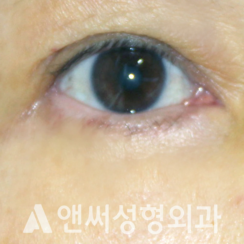 Answer Plastic Surgery case 399: After