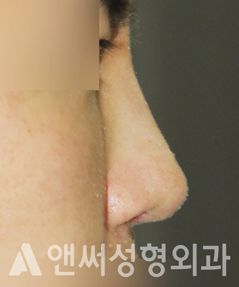 Answer Plastic Surgery case 398: After