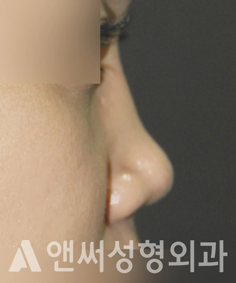Answer Plastic Surgery case 397: Before