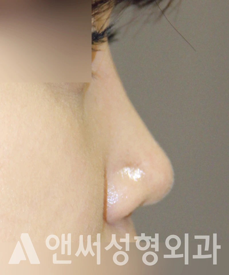 Answer Plastic Surgery case 397: After