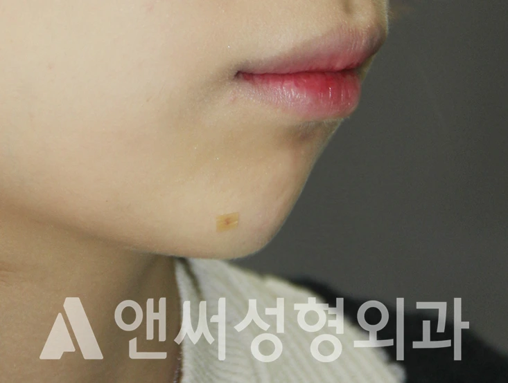 Answer Plastic Surgery case 396: Before