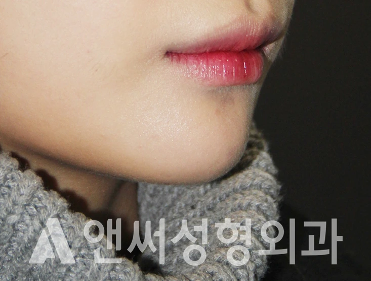 Answer Plastic Surgery case 396: After