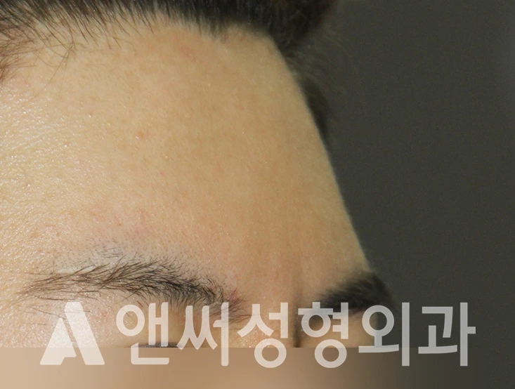 Answer Plastic Surgery case 395: After