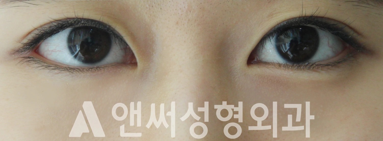 Answer Plastic Surgery case 394: After
