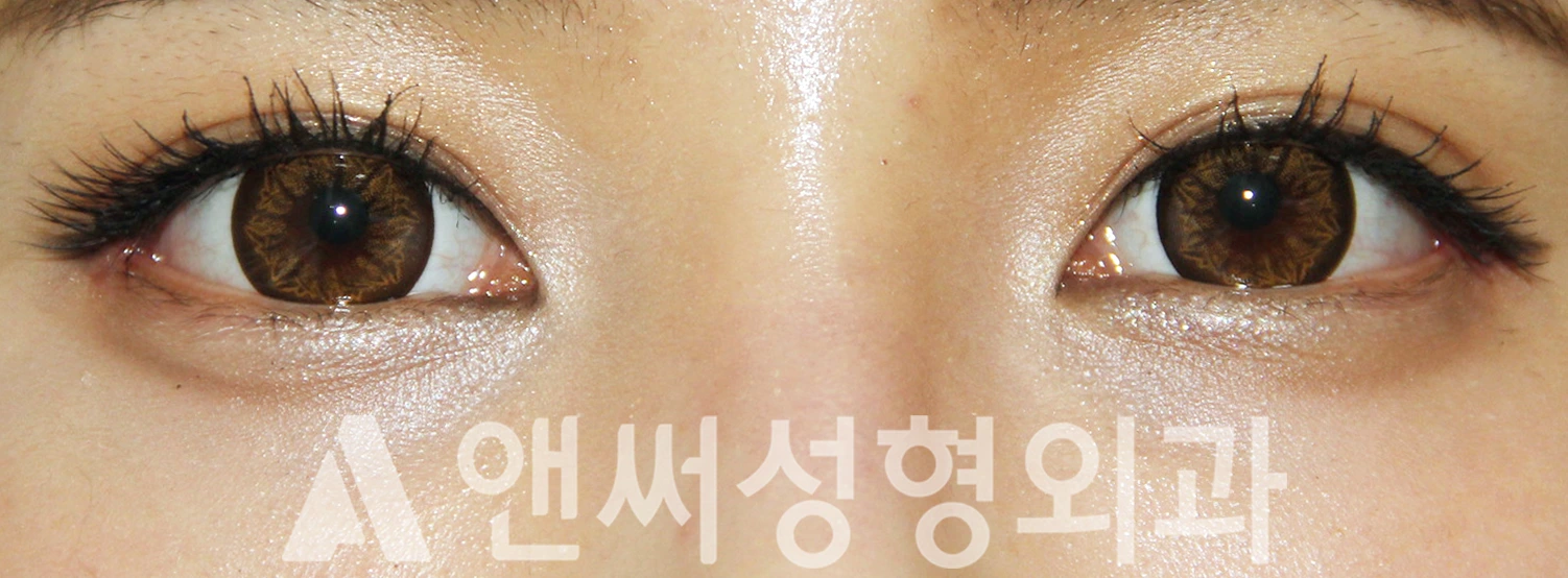 Answer Plastic Surgery case 392: After