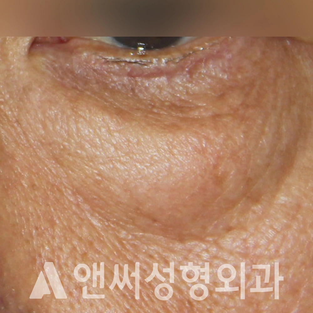 Answer Plastic Surgery case 391: Before