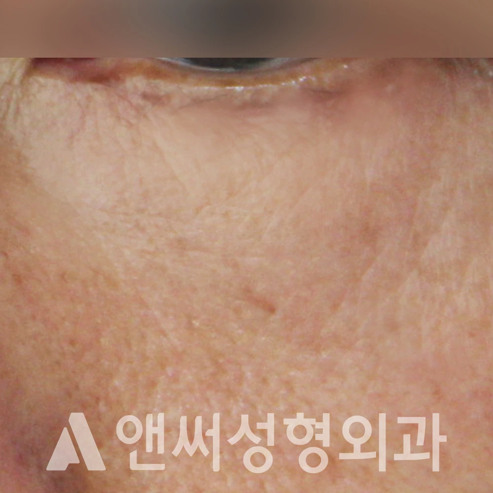 Answer Plastic Surgery case 391: After