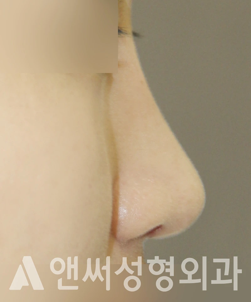 Answer Plastic Surgery case 390: After