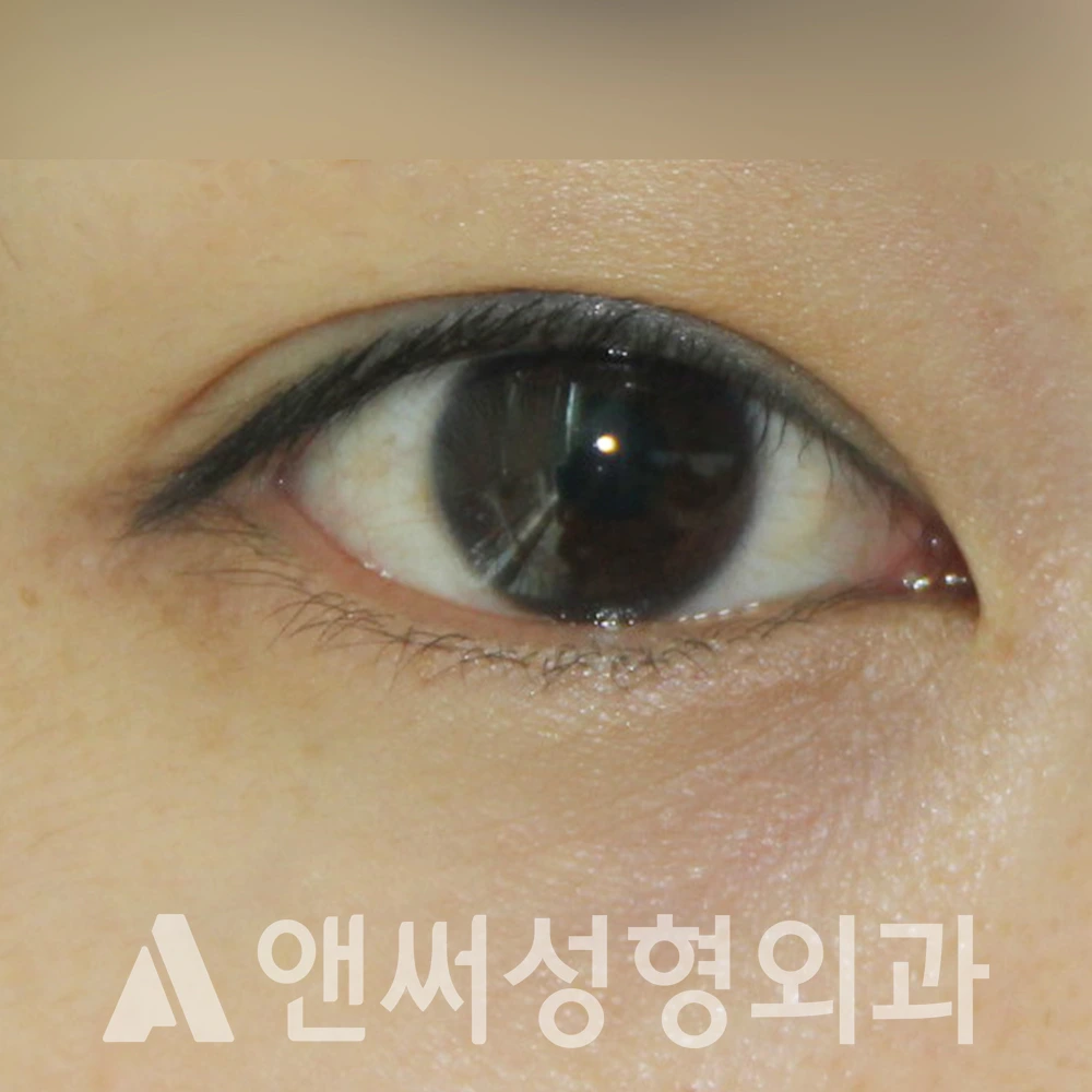Answer Plastic Surgery case 389: Before