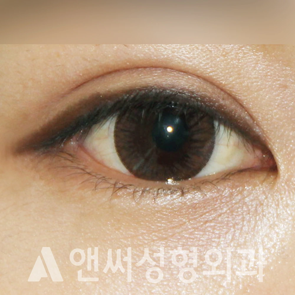 Answer Plastic Surgery case 389: After