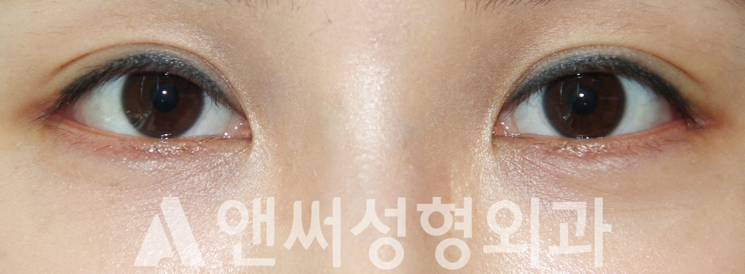 Answer Plastic Surgery case 388: After