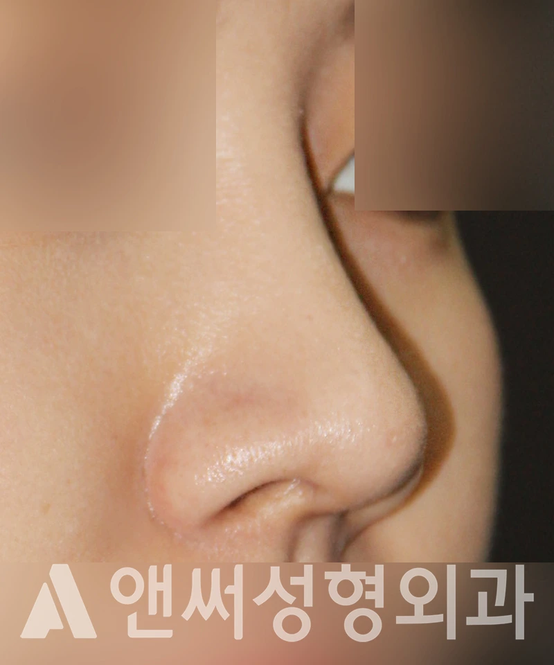 Answer Plastic Surgery case 387: After