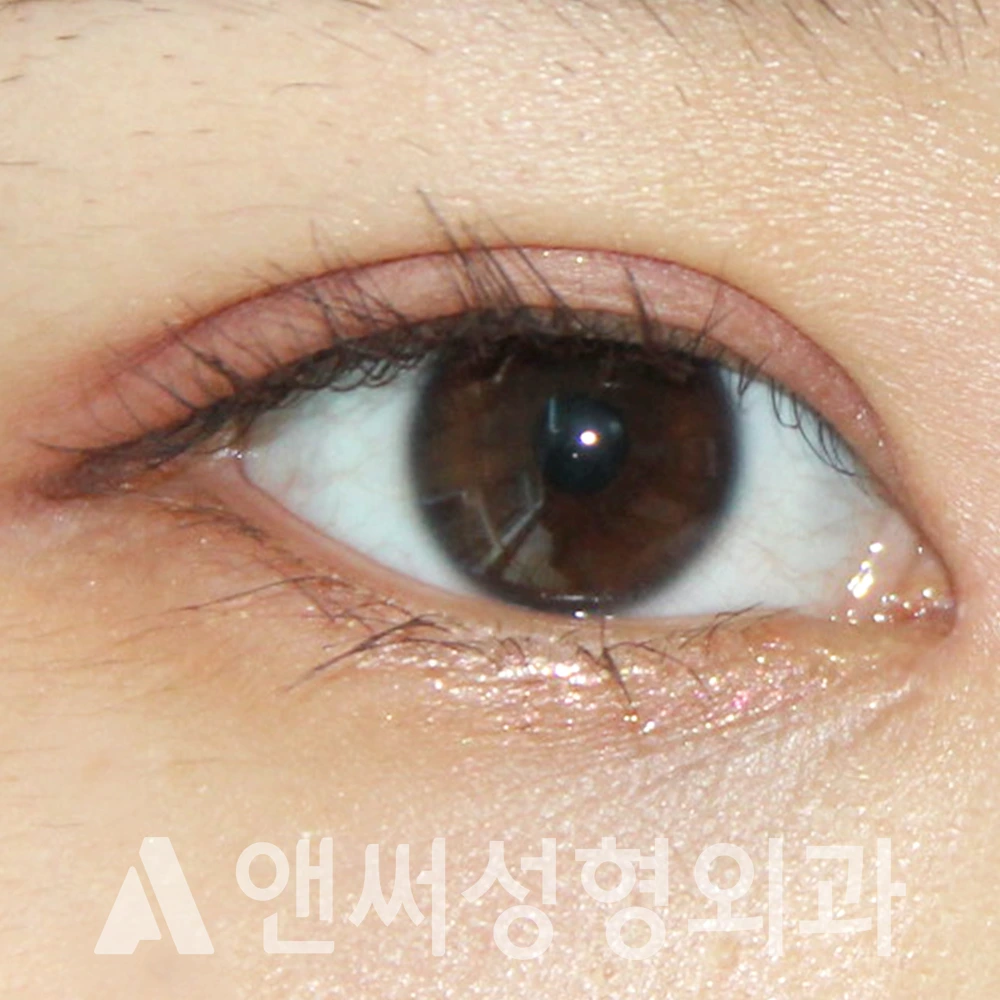 Answer Plastic Surgery case 386: After