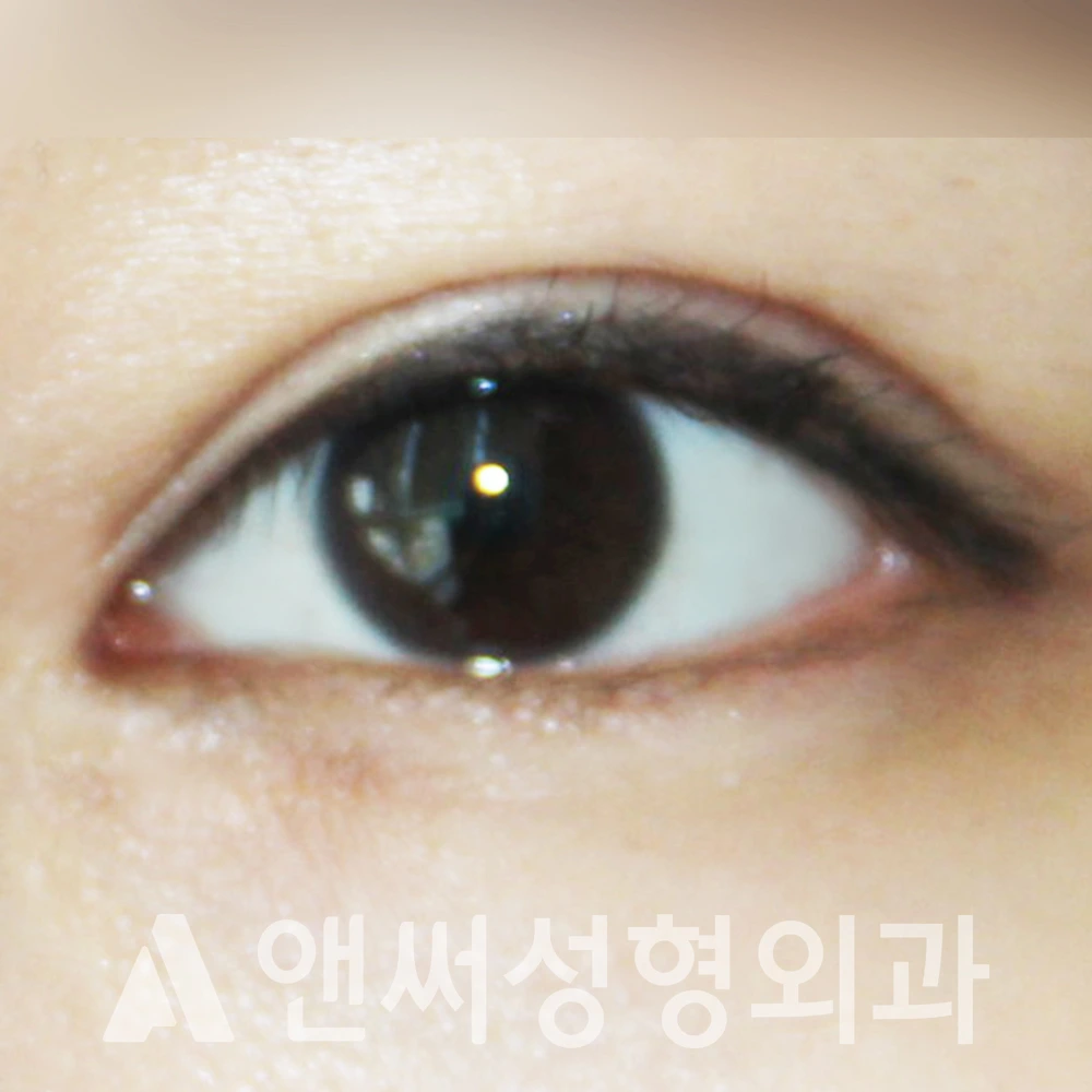 Answer Plastic Surgery case 385: After