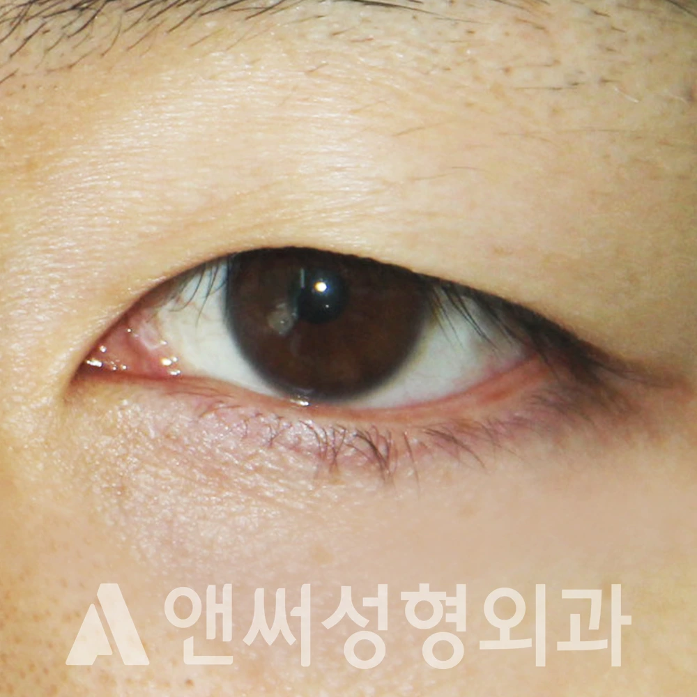 Answer Plastic Surgery case 384: Before