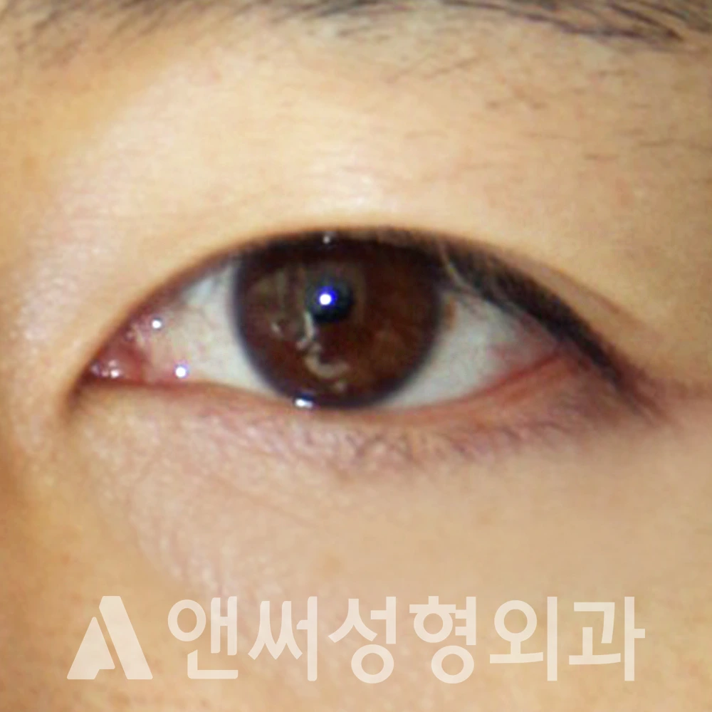Answer Plastic Surgery case 384: After