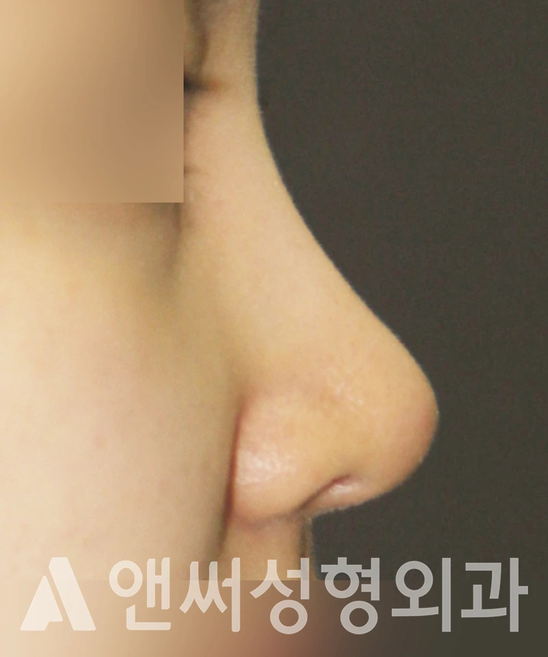 Answer Plastic Surgery case 383: After