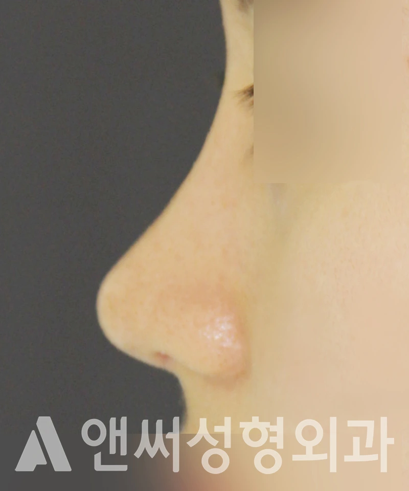 Answer Plastic Surgery case 382: After