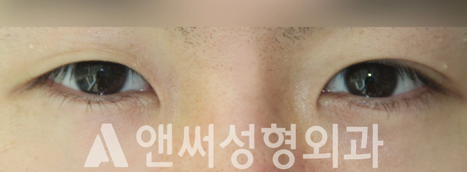 Answer Plastic Surgery case 381: Before