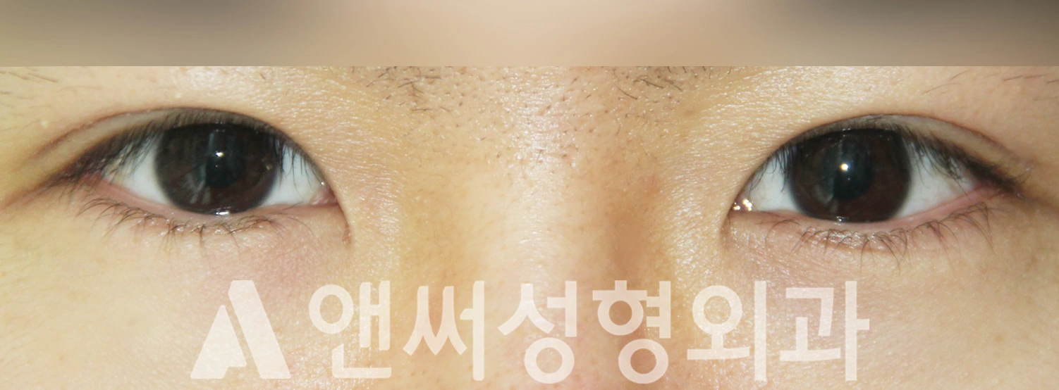 Answer Plastic Surgery case 381: After