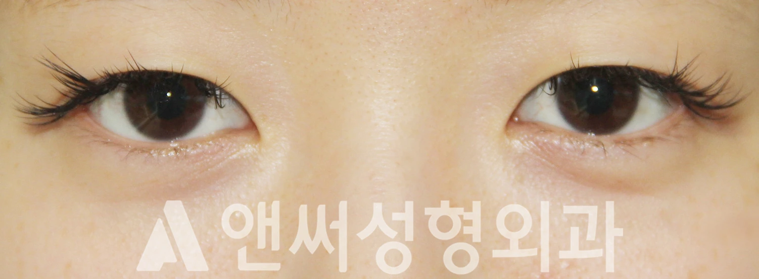 Answer Plastic Surgery case 380: Before