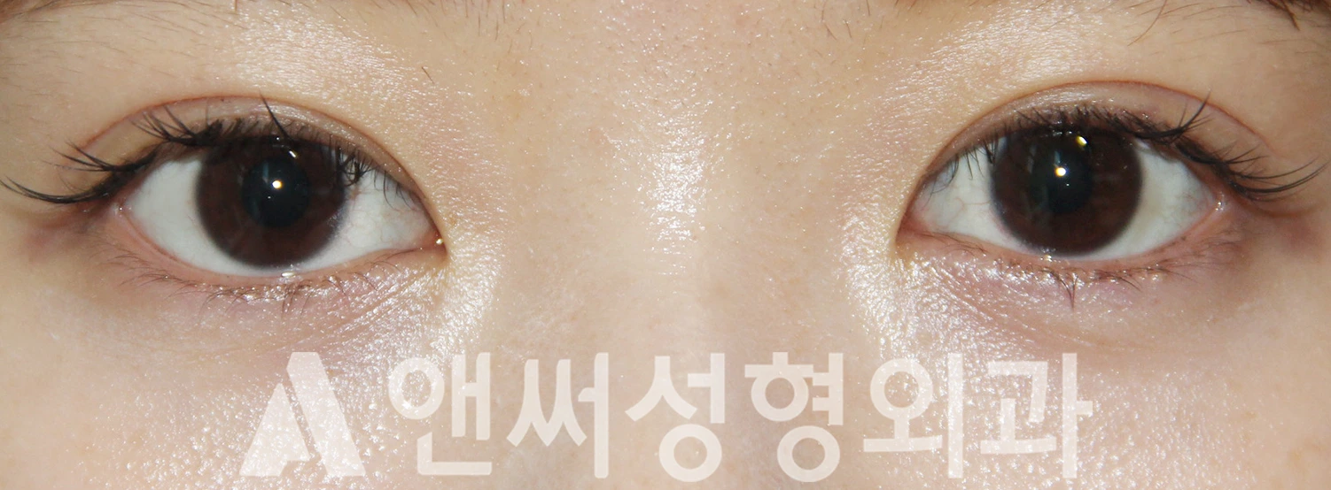 Answer Plastic Surgery case 380: After