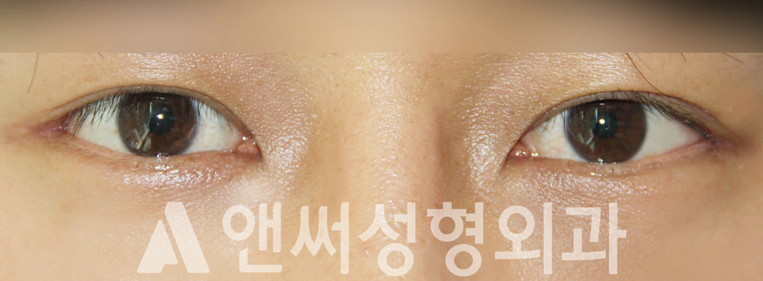 Answer Plastic Surgery case 379: After