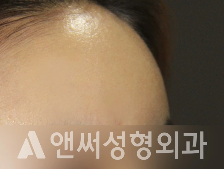 Answer Plastic Surgery case 378: After