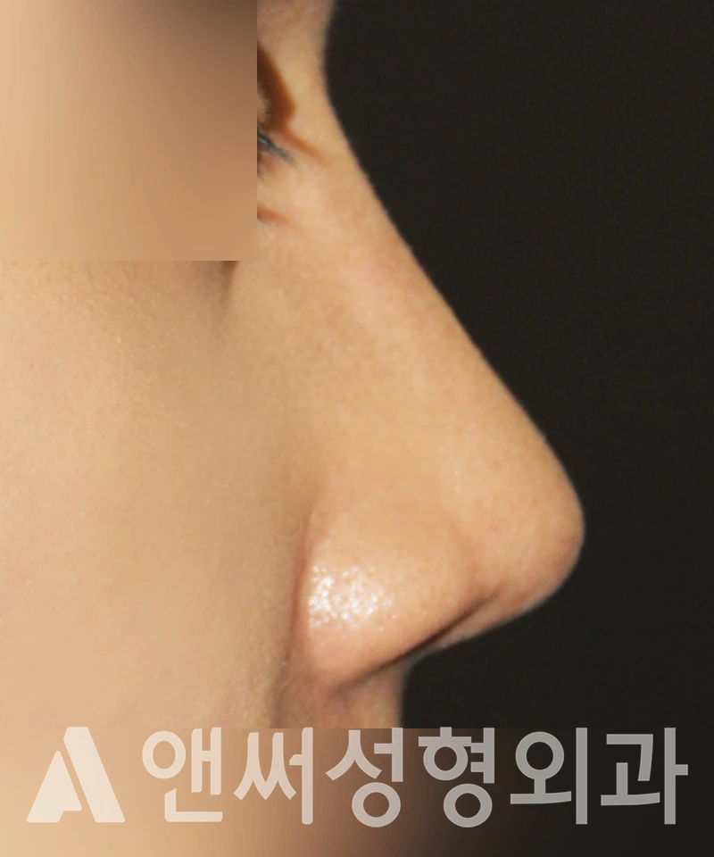 Answer Plastic Surgery case 377: After