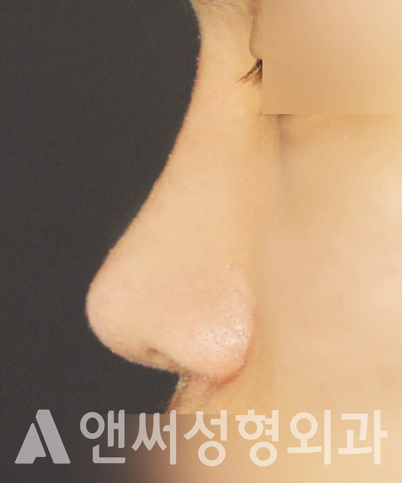 Answer Plastic Surgery case 376: After