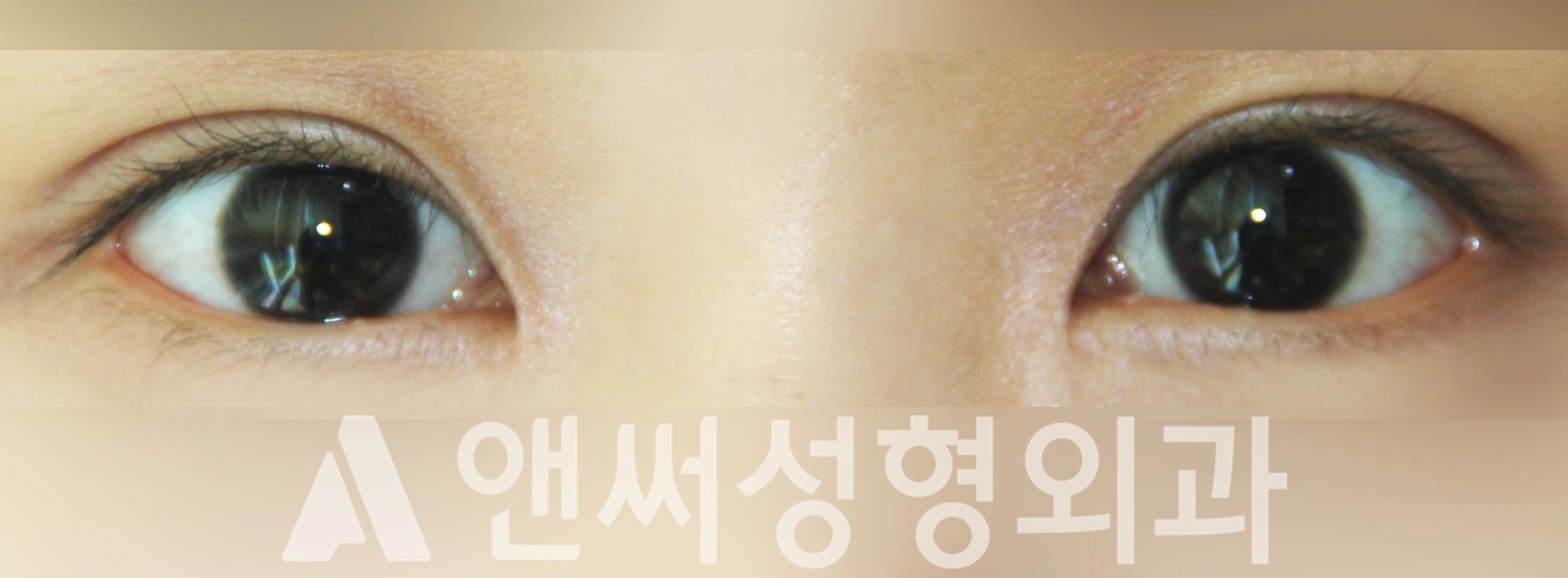 Answer Plastic Surgery case 375: After