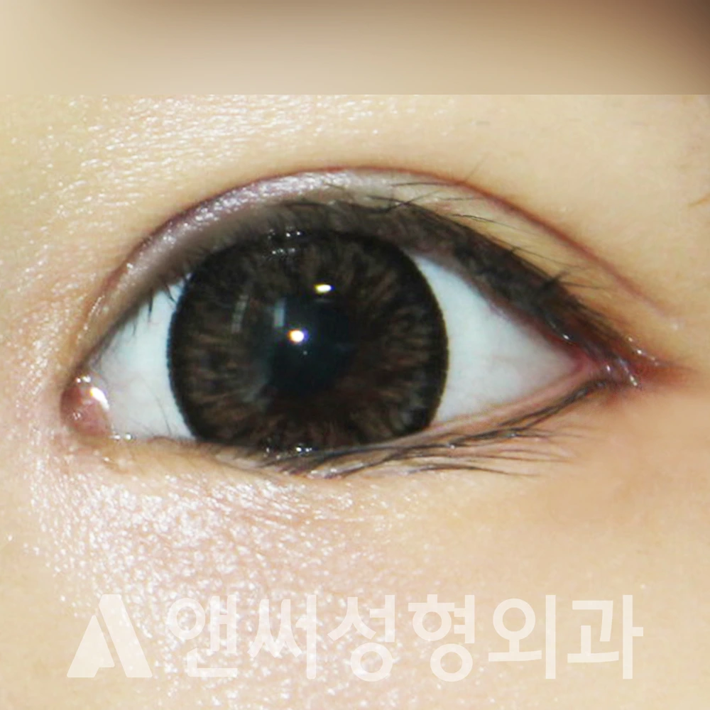 Answer Plastic Surgery case 374: After