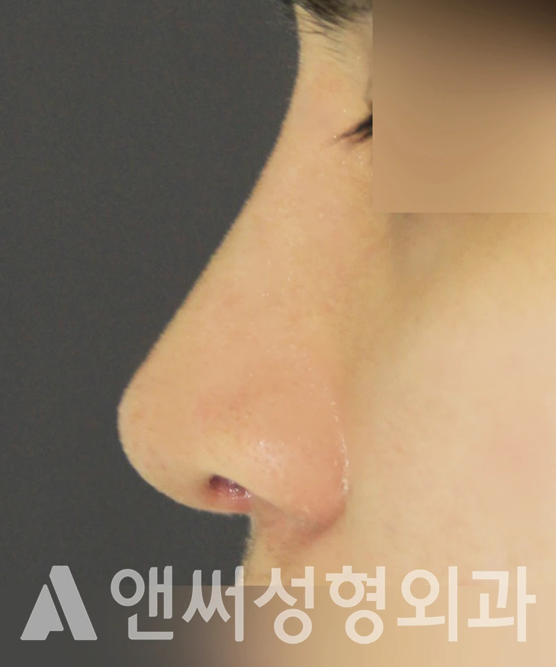 Answer Plastic Surgery case 373: After