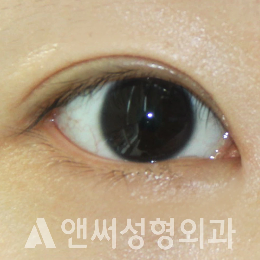 Answer Plastic Surgery case 371: After