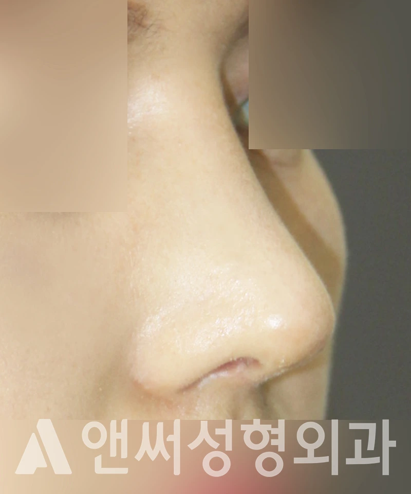Answer Plastic Surgery case 370: After
