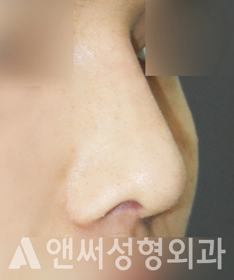 Answer Plastic Surgery case 369: After