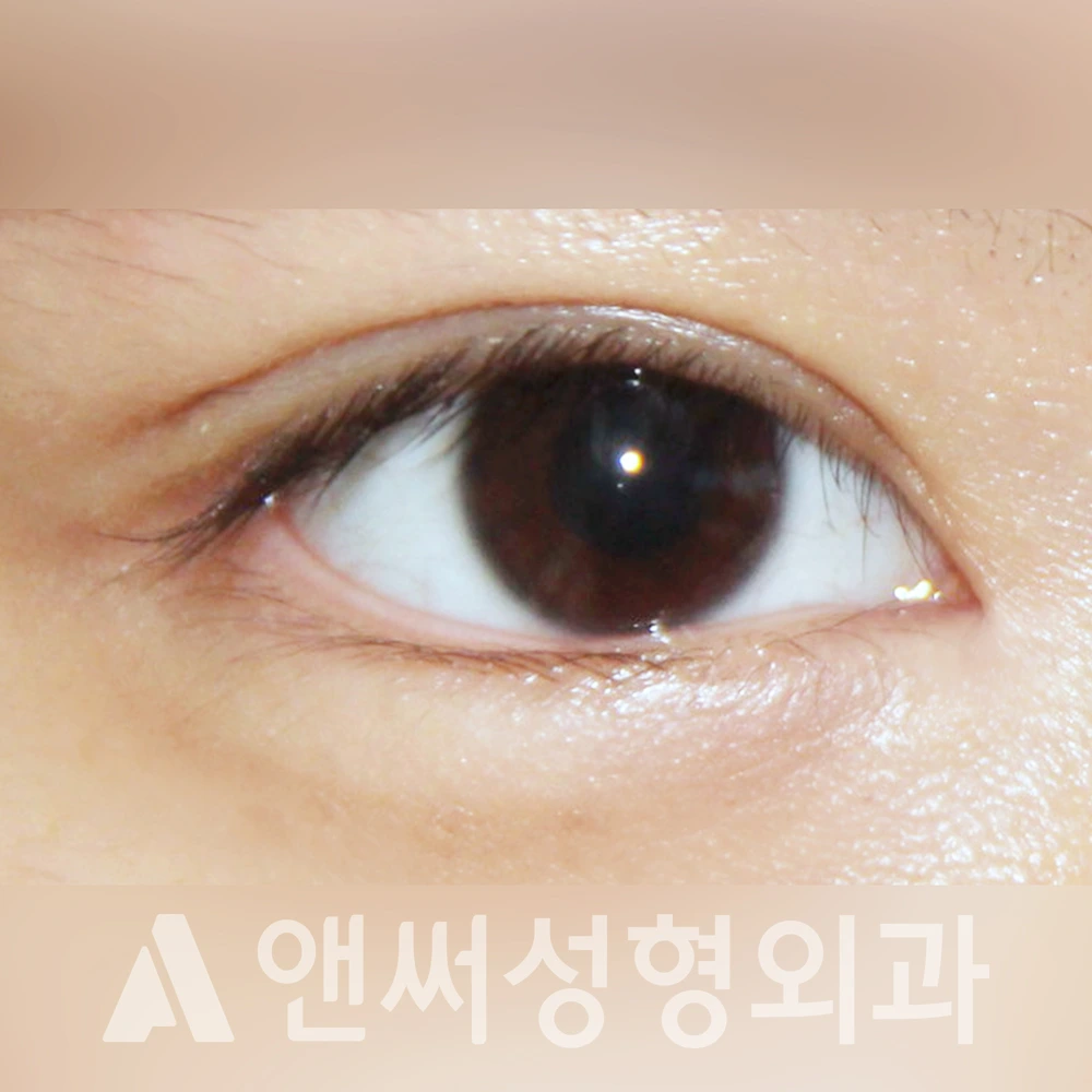 Answer Plastic Surgery case 368: After